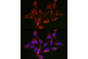 Immunofluorescence analysis of U-2 OS cells using SHC1 Rabbit pAb (ABIN6134103, ABIN6147738, ABIN6147739 and ABIN6223660) at dilution of 1:50 (40x lens). (SHC1 antibody)