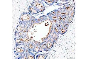 IHC analysis of MUC13 using anti-MUC13 antibody (ABIN6719597). (MUC13 antibody  (AA 226-312))