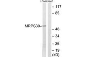 Western blot analysis of extracts from LOVO cells, using MRPS30 Antibody.