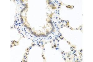 Immunohistochemistry of paraffin-embedded Rat lung using DEDD Polyclonal Antibody at dilution of 1:100 (40x lens).