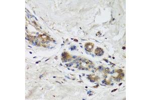 Immunohistochemistry (Paraffin-embedded Sections) (IHC (p)) image for anti-ISG15 Ubiquitin-Like Modifier (ISG15) (AA 1-165) antibody (ABIN3021653)