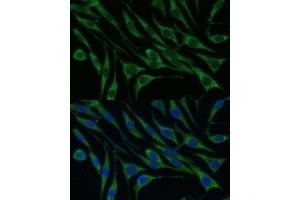 Immunofluorescence analysis of L929 cells using VARS Polyclonal Antibody (ABIN1683239, ABIN3018665, ABIN3018666 and ABIN6220533) at dilution of 1:100 (40x lens). (VARS antibody  (AA 1-280))