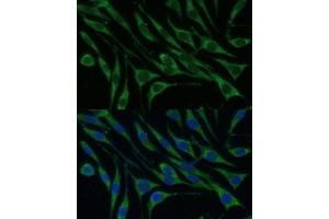 Immunofluorescence analysis of L929 cells using VARS Polyclonal Antibody (ABIN1683239, ABIN3018665, ABIN3018666 and ABIN6220533) at dilution of 1:100 (40x lens).