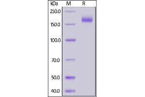 SARS-CoV-2 S protein, His Tag, Super stable trimer on SDS-PAGE under reducing (R) condition. (SARS-CoV-2 Spike Protein (Super Stable Trimer) (His tag))