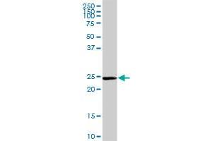 GSTM5 MaxPab rabbit polyclonal antibody. (GSTM5 antibody  (AA 1-218))