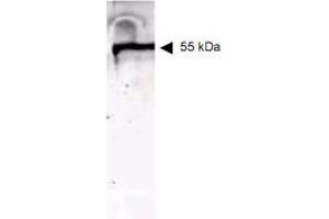 Western blot using Keratin monoclonal antibody, clone C11 .