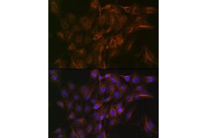 Immunofluorescence analysis of C6 cells using Arp3 Rabbit mAb (ABIN7265676) at dilution of 1:100 (40x lens). (ACTR3 antibody)