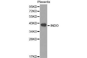 Western blot analysis of extracts of Placenta cell lines, using INDO antibody. (IDO1 antibody  (AA 204-403))