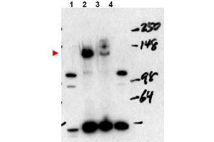 Image no. 1 for anti-Nuclear Receptor Coactivator 3 (NCOA3) (Internal Region), (Isoform A) antibody (ABIN401408) (NCOA3 antibody  (Internal Region, Isoform A))