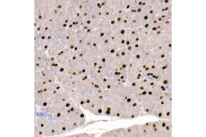 Immunohistochemistry (IHC) image for anti-GATA Binding Protein 4 (GATA4) antibody (ABIN7267359)