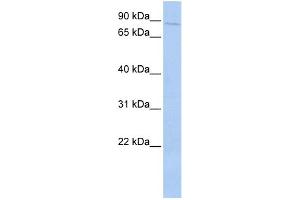 WB Suggested Anti-PRKRIR Antibody Titration: 0. (PRKRIR antibody  (N-Term))