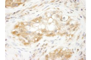 Immunohistochemistry (IHC) image for anti-Tripartite Motif Containing 3 (TRIM3) (AA 1-50) antibody (ABIN7448842) (TRIM3 antibody  (AA 1-50))