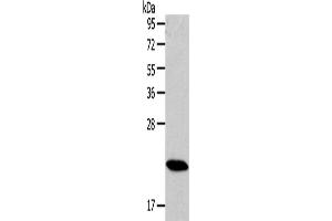 Western Blotting (WB) image for anti-RAB18, Member RAS Oncogene Family (RAB18) antibody (ABIN2430977) (RAB18 antibody)