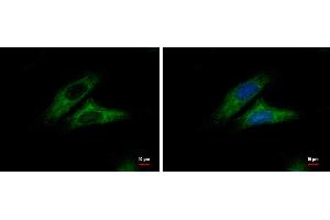 ICC/IF Image Alpha-catulin antibody [N3C2], Internal detects Alpha-catulin protein at cytoplasm by immunofluorescent analysis.