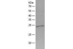 Western Blotting (WB) image for phosphoribosyl Transferase Domain Containing 1 (PRTFDC1) (AA 1-225) protein (His tag) (ABIN7289010) (PRTFDC1 Protein (AA 1-225) (His tag))