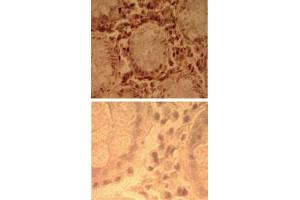 Immunohistochemical analysis of human colon tissue using TLR7 polyclonal antibody  (top) and an isotype control (bottom) at 5 ug/mL . (TLR7 antibody  (AA 706-728))