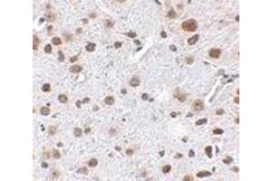 Immunohistochemistry of FTO in mouse brain tissue with FTO antibody at 2.