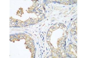 Immunohistochemistry of paraffin-embedded Human prostate using CBL Polyclonal Antibody at dilution of 1:200 (40x lens). (CBL antibody)
