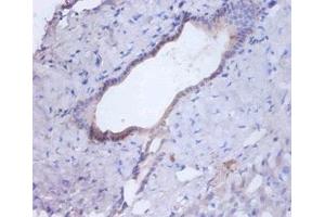 Immunohistochemistry of paraffin-embedded human liver tissue using ABIN7146996 at dilution of 1:100 (Cathepsin B antibody  (AA 82-333))