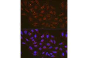 Immunofluorescence analysis of U2OS cells using  Rabbit pAb (ABIN6131258, ABIN6137246, ABIN6137247 and ABIN6223428) at dilution of 1:100 (40x lens). (ATG14 antibody  (AA 1-310))