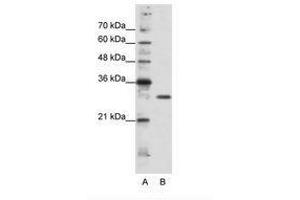 Image no. 2 for anti-Goosecoid Homeobox 2 (GSC2) (C-Term) antibody (ABIN202063)