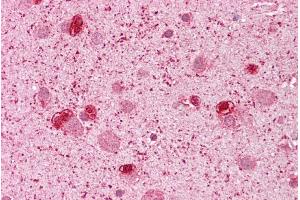 Immunohistochemistry with Brain, cortex tissue at an antibody concentration of 5µg/ml using anti-GSH2 antibody (ARP32208_P050) (GSX2 antibody  (N-Term))