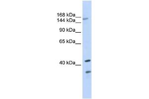 WB Suggested Anti-ABCC8 Antibody Titration:  0. (ABCC8 antibody  (N-Term))