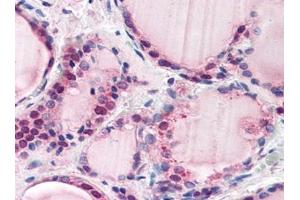Image no. 1 for anti-F-Box and Leucine-Rich Repeat Protein 3 (FBXL3) (N-Term) antibody (ABIN372963) (FBXL3 antibody  (N-Term))
