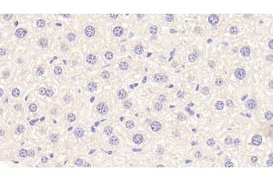 Detection of APOF in Mouse Liver Tissue using Polyclonal Antibody to Apolipoprotein F (APOF) (Apolipoprotein F antibody  (AA 111-314))