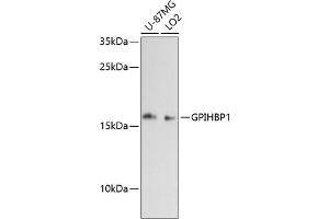 Western blot analysis of extracts of various cell lines, using GPIHBP1 antibody (ABIN6131315, ABIN6141330, ABIN6141331 and ABIN6217167) at 1:3000 dilution. (GPIHBP1 antibody  (AA 50-151))