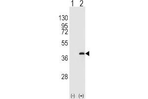 Western Blotting (WB) image for anti-Protein Phosphatase 1, Catalytic Subunit, beta Isoform (PPP1CB) antibody (ABIN3003759) (PPP1CB antibody)