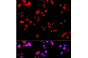 Immunofluorescence analysis of GFP-RNF168 transgenic U2OS cells using RPA2 Polyclonal Antibody (RPA2 antibody)