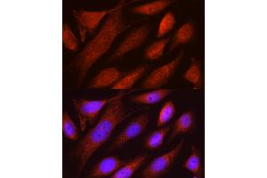 Immunofluorescence analysis of U2OS cells using RHOT2 Rabbit pAb (ABIN3016307, ABIN3016308, ABIN1682532 and ABIN6219710) at dilution of 1:50 (40x lens). (RHOT2 antibody  (AA 280-480))