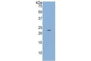 Western Blotting (WB) image for Calreticulin (CALR) ELISA Kit (ABIN6574281)