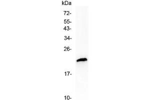 Western blot testing of human MCF7 cell lysate with TMEM107 antibody at 0. (TMEM107 antibody  (AA 22-57))