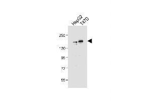 All lanes : Anti-HDAC6 Antibody (C-term) at 1:2000 dilution Lane 1: HepG2 whole cell lysate Lane 2: T47D whole cell lysate Lysates/proteins at 20 μg per lane. (HDAC6 antibody  (C-Term))