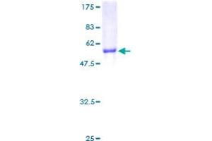 NNMT Protein (AA 1-264) (GST tag)
