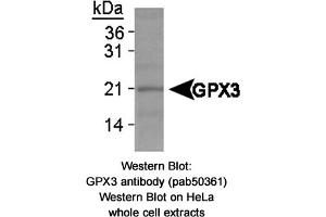 Image no. 1 for anti-Glutathione Peroxidase 3 (Plasma) (GPX3) antibody (ABIN363670) (GPX3 antibody)