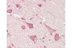 Formalin-fixed and paraffin-embedded H. (MYCN antibody  (C-Term))