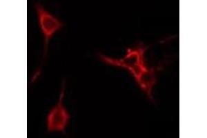 ABIN6274980 staining Hela cells by IF/ICC. (CDC42EP3 antibody  (Internal Region))