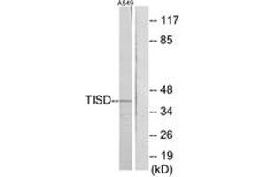 Western blot analysis of extracts from A549 cells, using TISD Antibody. (TISD antibody  (AA 207-256))