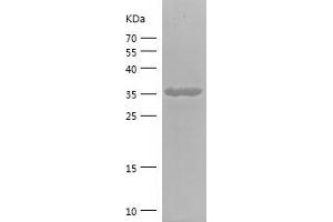 Western Blotting (WB) image for Carnitine O-Acetyltransferase (CRAT) (AA 23-113) protein (His-IF2DI Tag) (ABIN7282183) (CRAT Protein (AA 23-113) (His-IF2DI Tag))