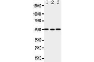 Western Blotting (WB) image for anti-X-Linked Inhibitor of Apoptosis (XIAP) (AA 14-34), (N-Term) antibody (ABIN3044425) (XIAP antibody  (N-Term))