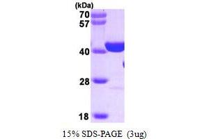 SDS-PAGE (SDS) image for Poly (ADP-Ribose) Polymerase 1 (PARP1) (AA 662-1014) protein (ABIN666940) (PARP1 Protein (AA 662-1014))