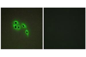 Immunofluorescence analysis of A549 cells, using DOK6 antibody. (DOK6 antibody  (Internal Region))