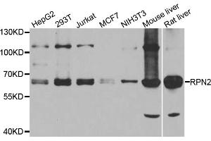 Western blot analysis of extracts of various cell lines, using RPN2 antibody (ABIN5974836) at 1/1000 dilution. (Ribophorin II antibody)
