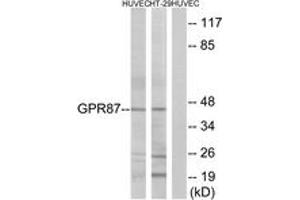 Western blot analysis of extracts from HuvEc/HT-29 cells, using GPR87 Antibody. (GPR87 antibody  (AA 221-270))