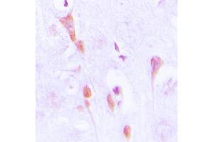 Immunohistochemical analysis of Beta-arrestin-1 (pS412) staining in human brain formalin fixed paraffin embedded tissue section.