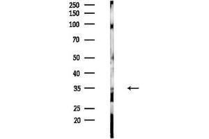 anti-alpha-2-Glycoprotein 1, Zinc-Binding (AZGP1) (Internal Region) antibody
