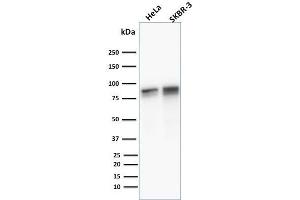 Western Blot Analysis of human HeLa and SKBR3 cell lysate using Catenin, gamma Mouse Monoclonal Antibody (11E4) (JUP antibody)